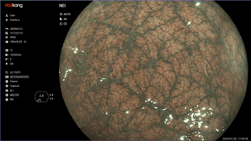 ELI Imaging