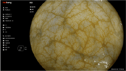 REI Imaging